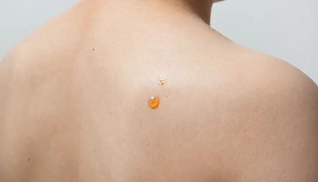 慢病管理套餐:慢性病防控的业务发展趋势分析